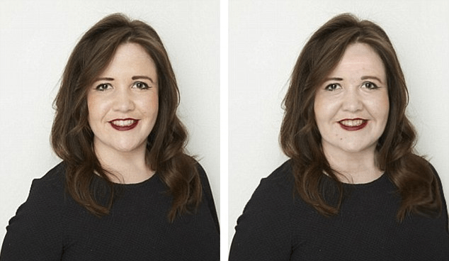 Before and after comparison of a woman's face showing clearer skin after reducing sugar consumption.